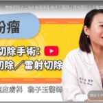 【雙和醫院】粉瘤切除手術：傳統切除／二氧化碳雷射 (翁子玉醫師)