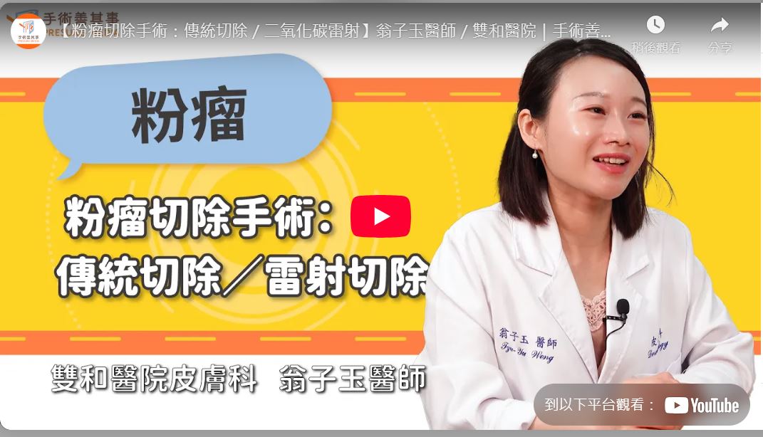 【雙和醫院】粉瘤切除手術：傳統切除／二氧化碳雷射 (翁子玉醫師)